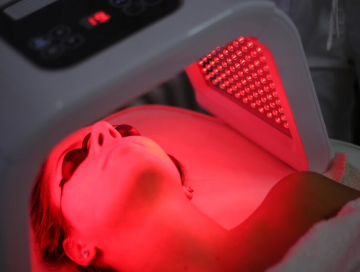 Red Light Therapy Before and After