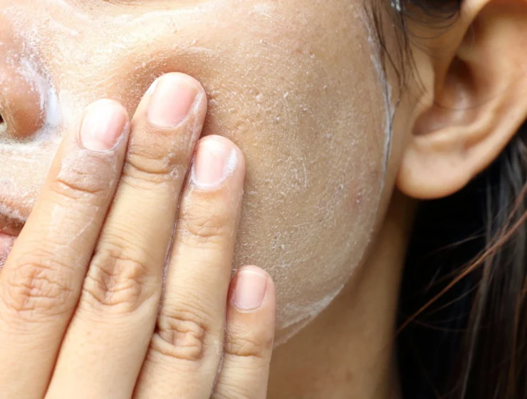 chemical exfoliants vs physical exfoliants