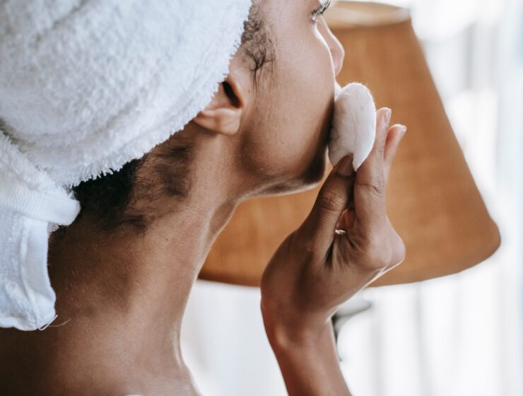 How to treat sunburn using natural remedies