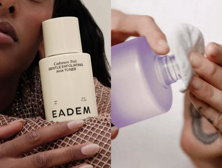 Best toner for acne-prone and oily skin