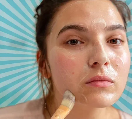 how to treat acne scars naturally at home