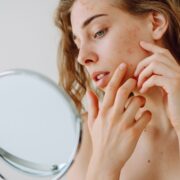 Natural ways to reduce forehead acne