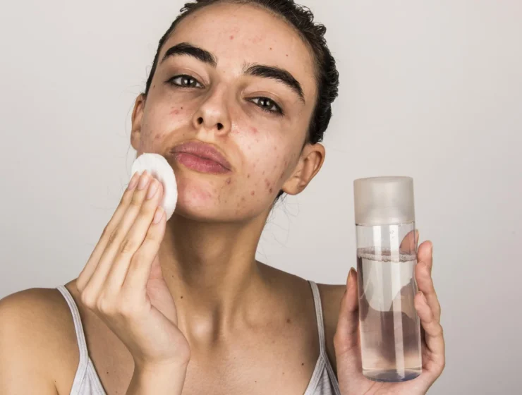 affordable skincare routine for acne prone skin
