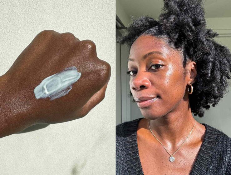 Best sunscreens for oily and acne-prone skin