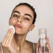skincare routine for sensitive acne prone skin