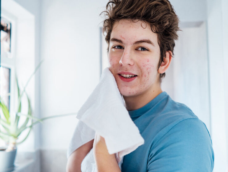 Daily facial cleansing routine for teenagers