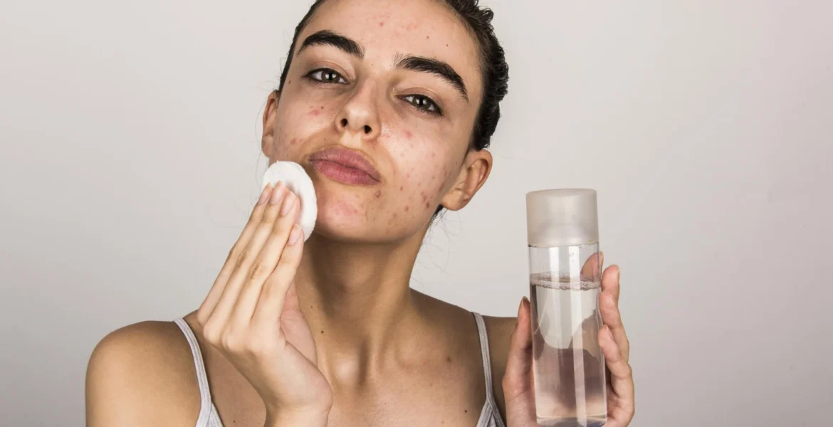 best skincare routine for oily acne-prone skin in summer