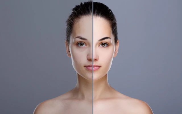 how to fix uneven skin tone with simple skincare tips