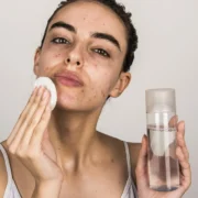 best skincare routine for oily and acne prone skin