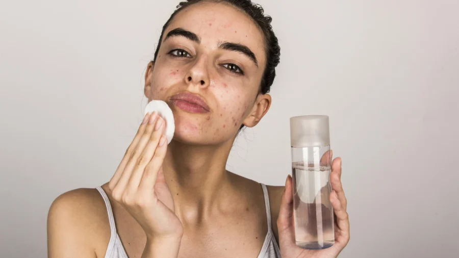best skincare routine for oily and acne prone skin